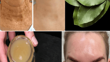 Drink Apple Cider Vinegar Every Night — What Happens Next Will Surprise You!