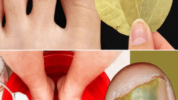 Guava Leaf Tea: 9 Amazing Benefits and the Simple Recipe Behind It!