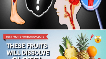 LIVER is DYING! 12 Warning Signs Your Feet Tell You About Your Liver Health