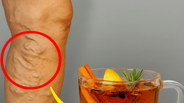 The Green Ally: 17 Reasons Stinging Nettle Deserves a Place in Your Life