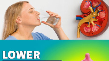 Grows Everywhere: If You See This Tree in Your Garden, You’re Sitting on Gold and Don’t Even Know It! – Polyscias fruticosa