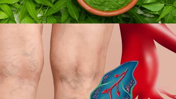 Top Remedies to Get Rid of Dark Lips – Say Goodbye to Discoloration Naturally!