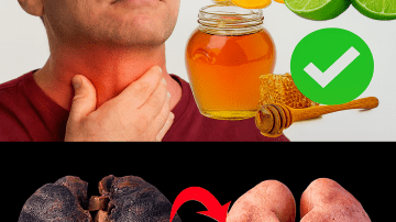 Grows Everywhere: If You See This Tree in Your Garden, You’re Sitting on Gold and Don’t Even Know It! – Polyscias fruticosa