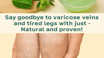 Best Remedy for Hyperpigmentation: Unlock Radiant Skin Naturally