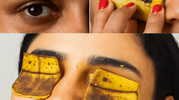 Top Superfoods to Supercharge Your Kidney Health