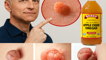 How to Use Banana and Tomato at Home for a Fresher, Smoother Look — Simple DIY Method