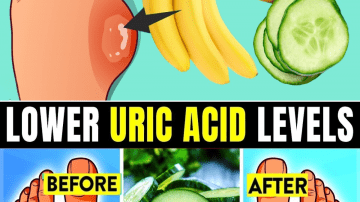 Leg Pain, Varicose Veins, and Arthritis: The Overlooked Path to Relief – Healthy Life! – Use Black Pepper