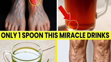 10 Superfoods for Strong Bones and Preventing Osteoporosis