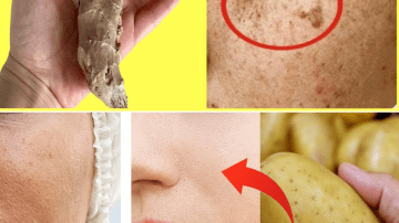 SENIORS, PLEASE! Just 3 Minute Fix For Crepey Skin That Actually Works!