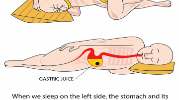 Avoid These 7 Plant-Based Foods That Can Damage Your Kidneys