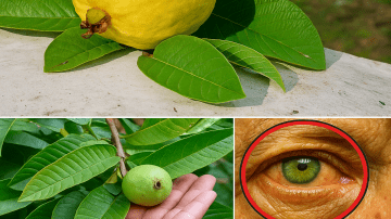 Avoid These 7 Plant-Based Foods That Can Damage Your Kidneys