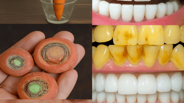 10 Superfoods for Strong Bones and Preventing Osteoporosis