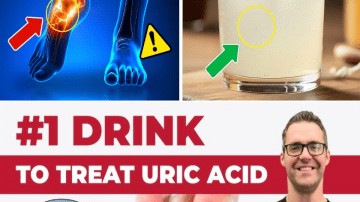 Goodbye Varicose Veins: Natural Ways to Support Healthy Legs