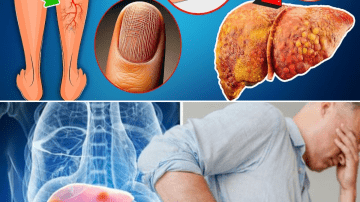 The Ancient Secret in Guava Leaves Modern Wellness Is Rediscovering