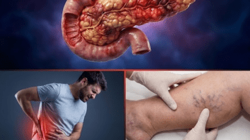 Cloves and Beyond: Ancient Spice, Modern Benefits