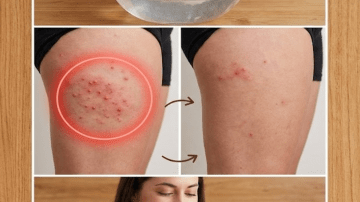 I Started Chewing 2 Raw Garlic Cloves Daily—And Said Goodbye to These 10 Common Health Issues