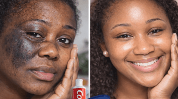 You Won’t Believe What Cloves Can Do for Your Health (Pharmacist Explains 18 Hidden Powers)