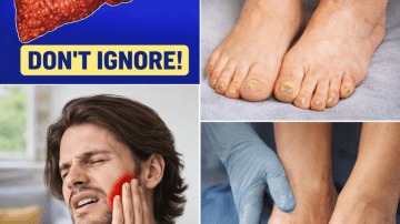 12 Signs of Pancreatic Cancer You Should Never Ignore!