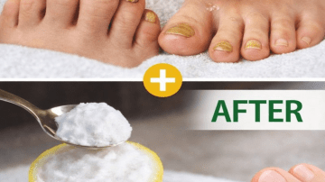 The Secret to Healthy Arteries and Better Circulation – Why Black Seed Oil is the Ultimate Choice!