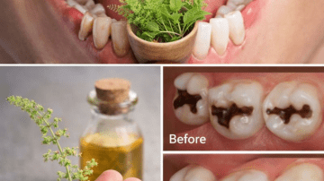 Watch Out! 8 Signs of Dangerous Blood Clots