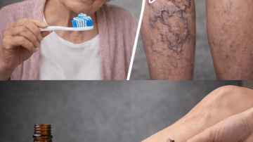 Control Blood Sugar, Arthritis, Cholesterol, Poor Circulation, Fatty Liver & More with This One Remedy – The Oregano Miracle Doctors Ignore